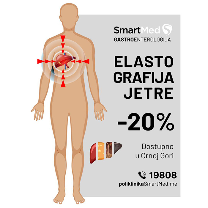 specijalna akcija